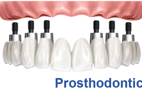 prosthodontics